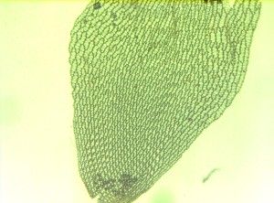 Fot. 3. Zdjęcie mikroskopowe powierzchni liścia torfowca z widocznym dużymi komórkami wodonośnymi, otoczonymi mniejszymi, ciemnozielonymi komórkami zawierającymi chlorofil.